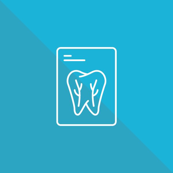 Dantų kanalų gydymas mikroskopu (endodontija)